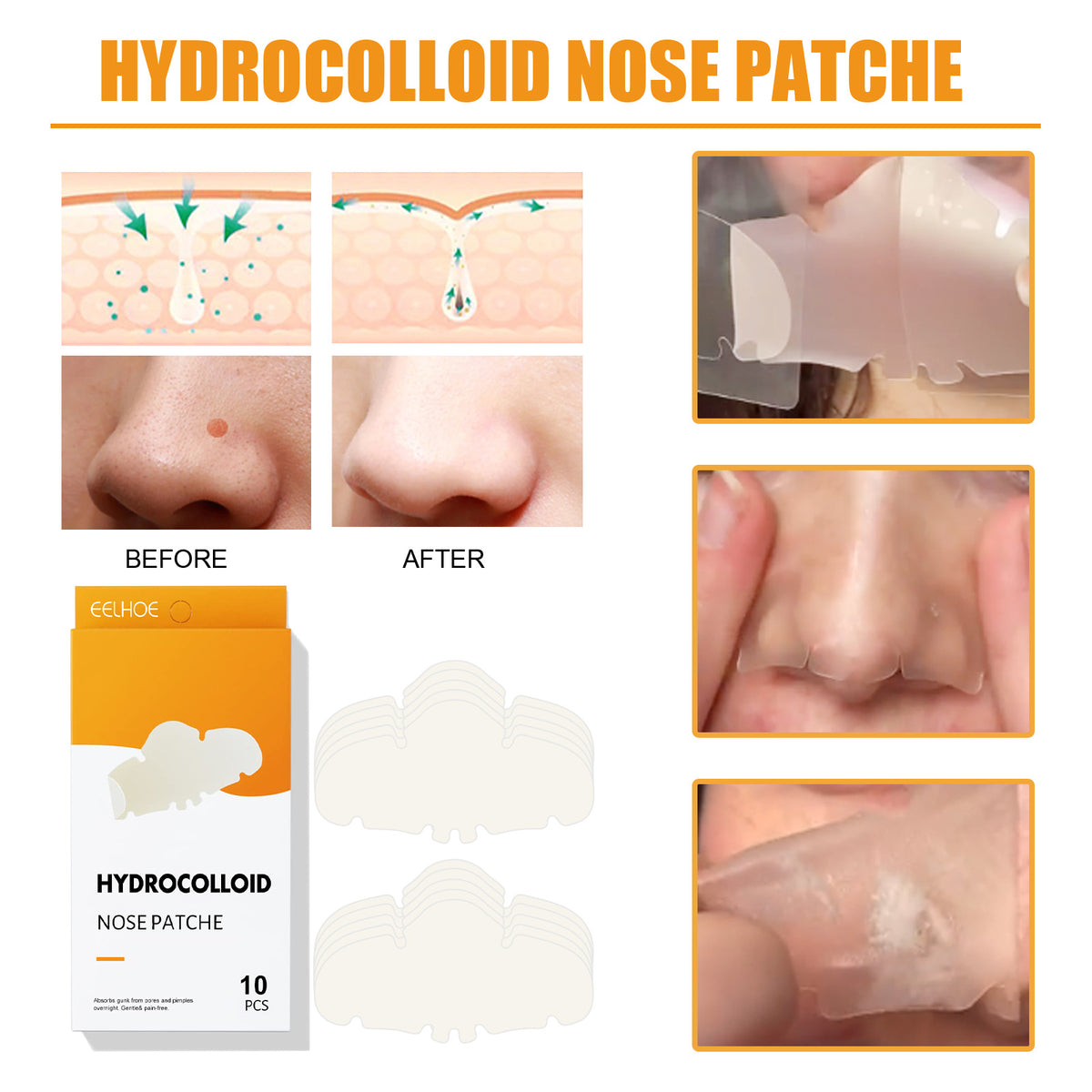 Peel-Off Pore Sticks